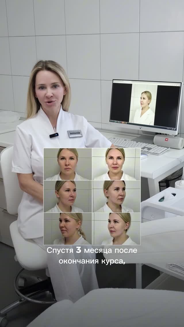 Подтяжка контуров лица: RF-микроигольчатый и контурная пластика