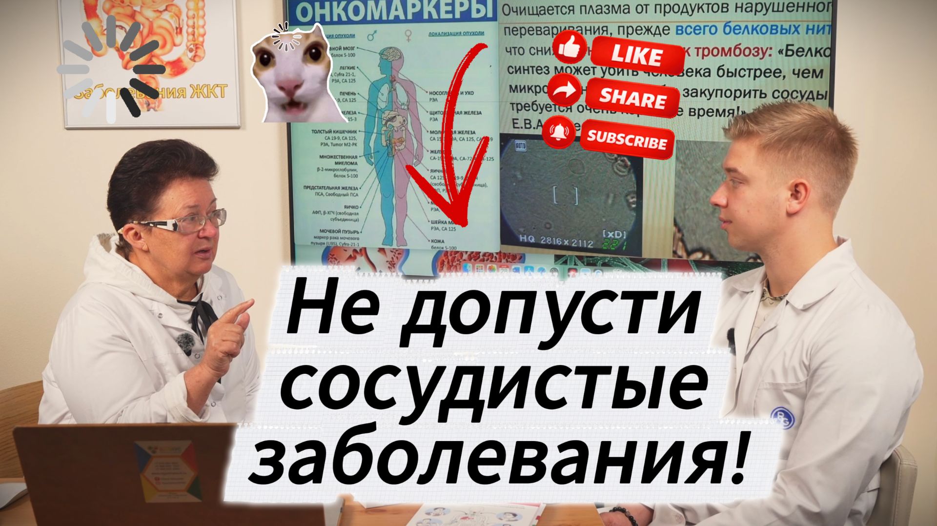 Как разжижить кровь? смотреть онлайн