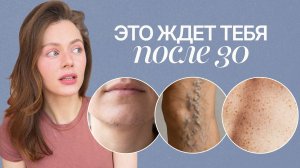 ТЕЛО после 30: я была В ШОКЕ, когда появилось это...