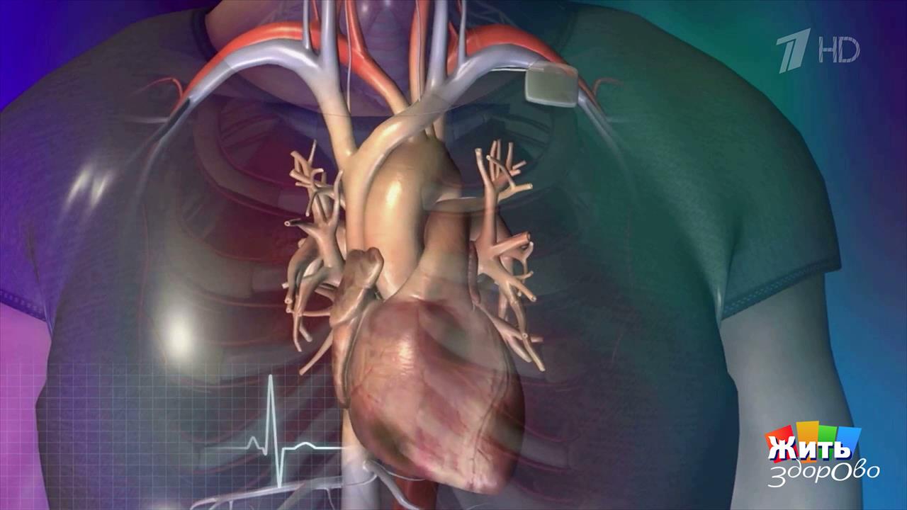 Спасительный разряд: все о дефибрилляторах. Жить здорово! Фрагмент выпуска от 04.06.2026 смотреть онлайн