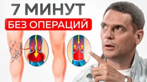 2 простых действия избавят от варикоза НАВСЕГДА?!