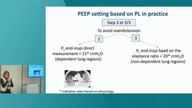 ESOPHAGEAL PRESSURE MONITORING ISICEM 45 смотреть онлайн