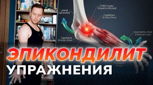 ЭПИКОНДИЛИТ ЛОКТЯ делаю только эти упражнения от боли в локте