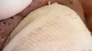 #590 Чистка лица от угрей и акне. Выдавливание прыщей. Удаление черных точек и комедонов