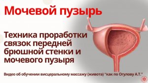Мочевой пузырь. Техника проработки связок передней брюшной стенки и мочевого пузыря.