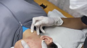 Очищение кожи от угрей. Расслаблющее видео.