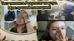 Тест пилинга.Результат на утро.Муж-лучший помощник!