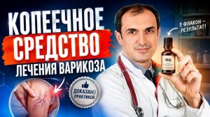 Копеечное средство лечения варикоза. Флеболог Москва.