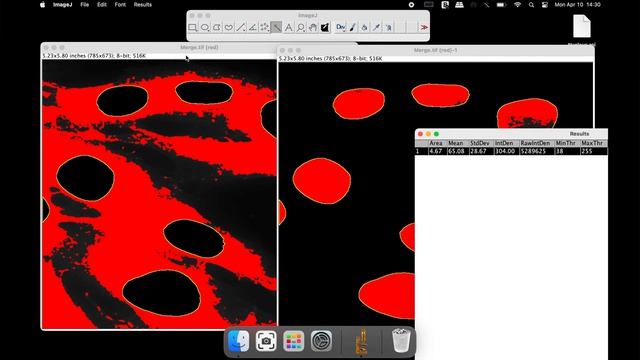 1. image J scanning electron microscop 
2. quantification in IHC 
3. how to measure 
4. how to calcu