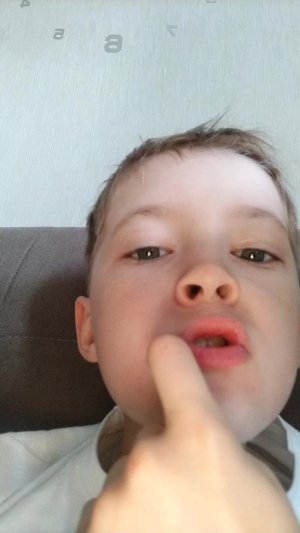 плато го мир