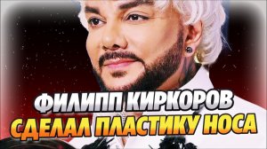 У Филиппа Киркорова новое лицо ★ Новости Шоу-Бизнеса