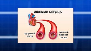 Про здоровье - 07.06.26