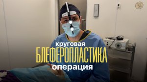 Блефаропластика верхних и нижних век: разметка и операция глазами пациента