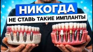 Все виды ИМПЛАНТОВ в 1 видео! Какой имплант выбрать в 2026 году?