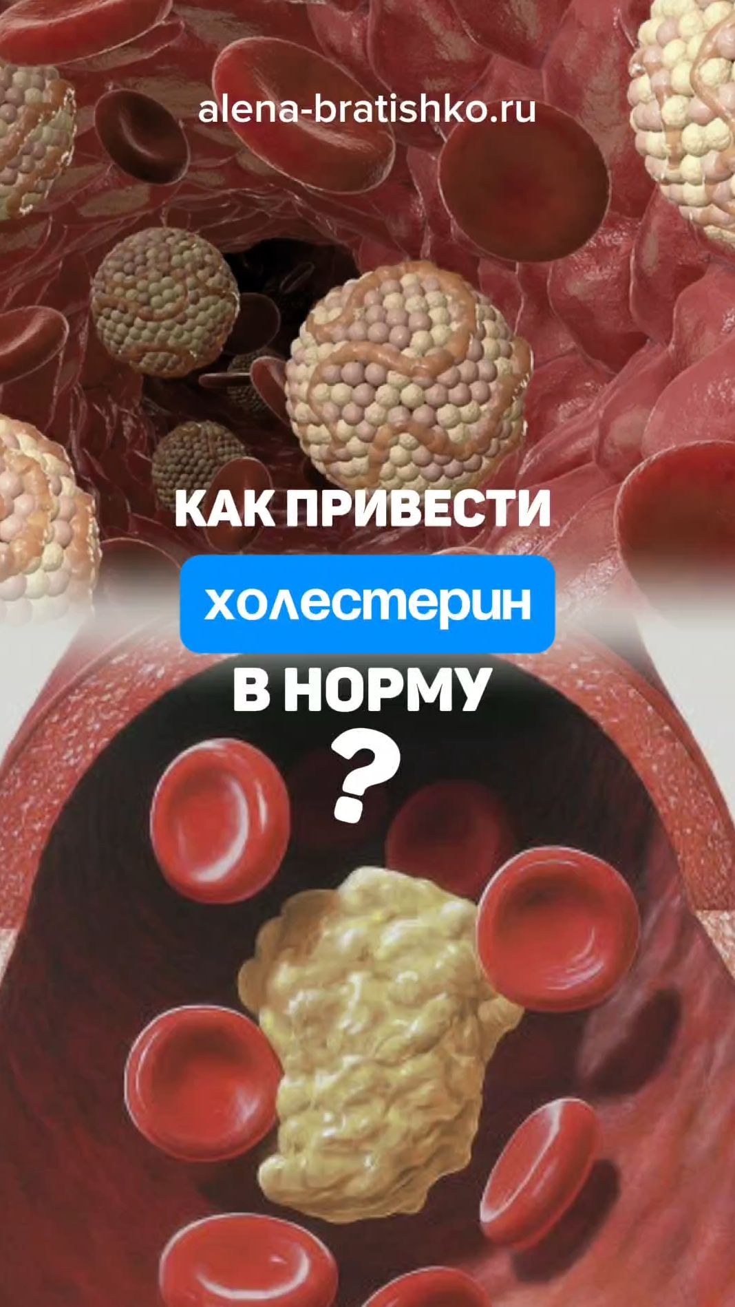 Как привести холестерин в норму. Семейный доктор Алена Братишко
