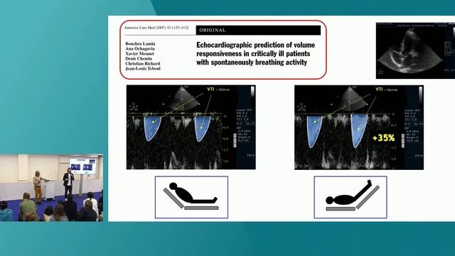 TTE-TEE IN SEPTIC SHOCK ISICEM 45 смотреть онлайн