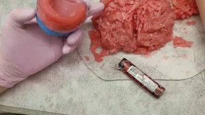 Техника изготовления восковых шаблонов при полной потере зубов.
