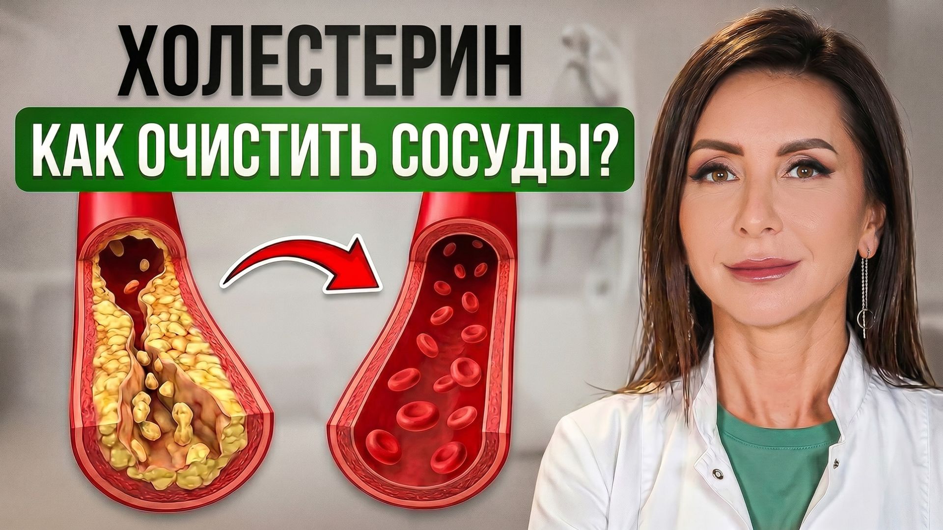 Как снизить ХОЛЕСТЕРИН без СТАТИНОВ и избавиться от атеросклероза!