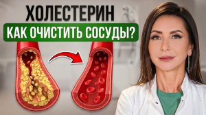 Как снизить ХОЛЕСТЕРИН без СТАТИНОВ и избавиться от атеросклероза!