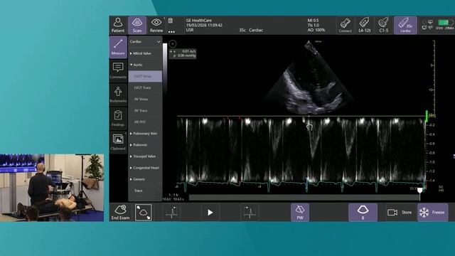 POINT-OF-CARE ULTRASONOGRAPHY TO IDENTIFY FLUID INTOLERANCE ISICEM 45 смотреть онлайн