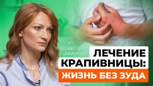 Крапивница: разбираемся в причинах и лечении