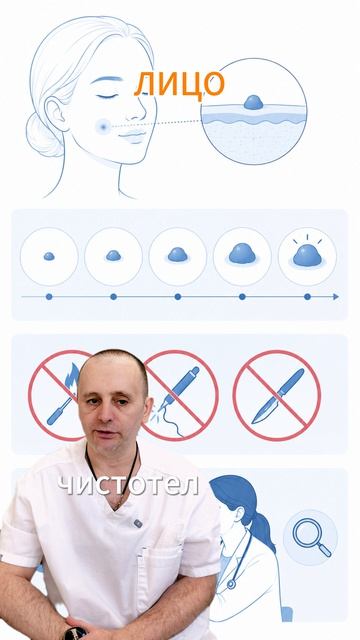 Бородавка на лице растёт — почему нужен осмотр
