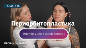 Носогубные складки в молодом возрасте | Периорбитопластика у доктора Алисы Лисицыной