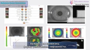 Кератотопография роговицы. Клиника «Папа, мама и малыш»