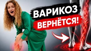 Варикоз: врачи лечат не причину! Почему вены появляются снова