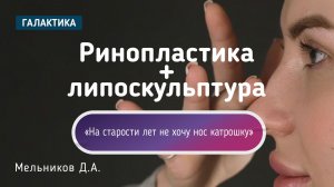 Риносептопластика и липосакция живота | Тереза у Дмитрия Мельникова