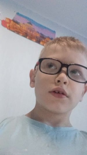 Я спалил своё лицо
