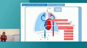 FLUID RESPONSIVENESS IN A MECHANICALLY VENTILATED PATIENT