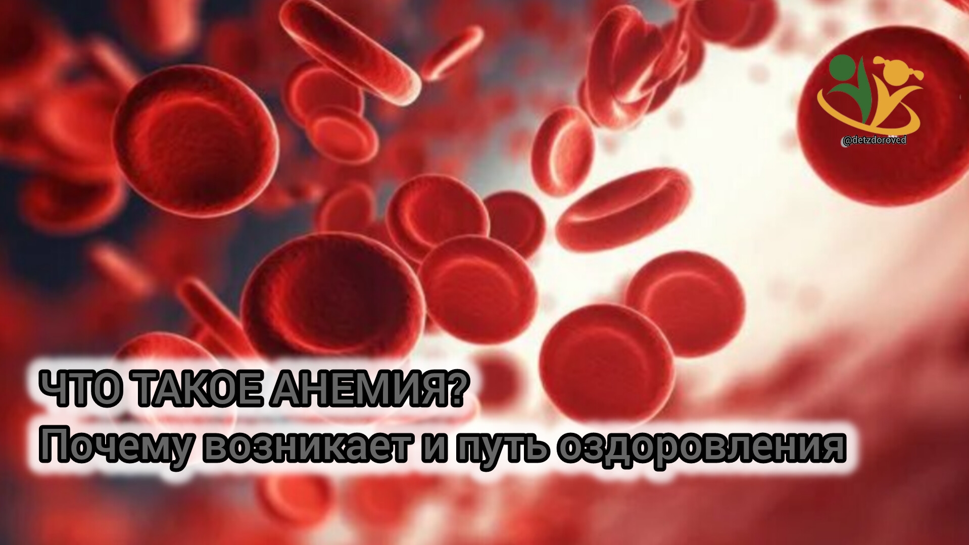 💥ЧТО ТАКОЕ АНЕМИЯ? Почему возникает и путь оздоровления. О.А.Бутакова