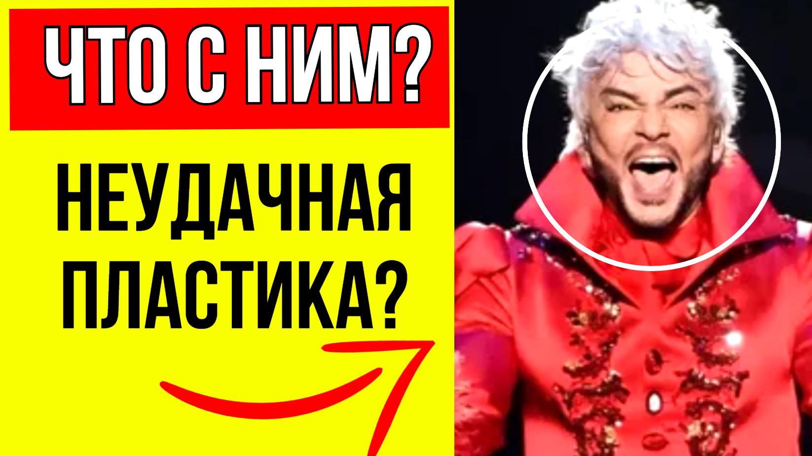 Киркоров В ЯРОСТИ! Певец сорвался на репортеров после вопроса о пластике его носа