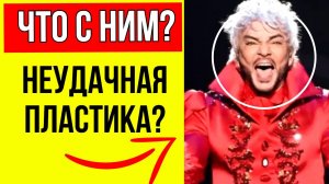 Киркоров В ЯРОСТИ! Певец сорвался на репортеров после вопроса о пластике его носа