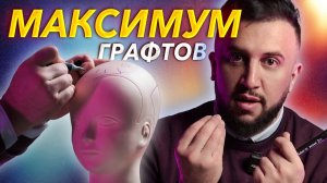 БАЗОВЫЕ ЗНАНИЯ О ПЕРЕСАДКЕ ВОЛОС FUE, KEEP, DHI