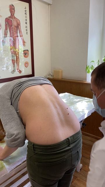 Тейпирование Врач-остеопат Мещеряков Алексей Викторович