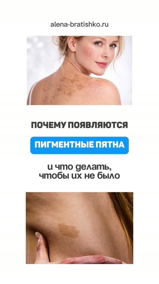 Почему появляются пигментные темные пятна и что с ними делать? Семейный доктор Алена Братишко