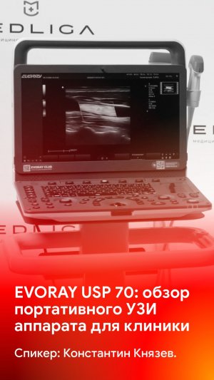 EVORAY USP 70 в работе: оценка возможностей на реальных исследованиях