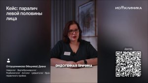 Паралич левой половины лица