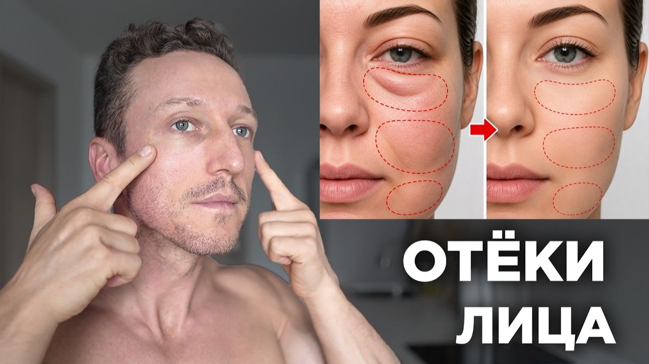 Как БЫСТРО Убрать ОТЕКИ с Лица?! Упражнения от ОТËКОВ!