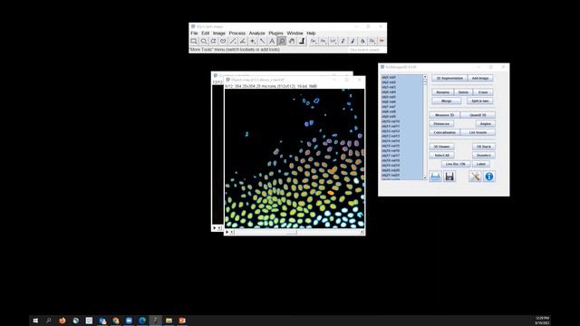 8 урок image J маски трешхолд Threshold Image J смотреть онлайн