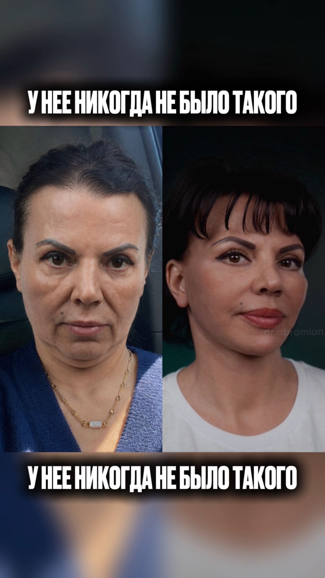 никогда не было такого смотреть онлайн