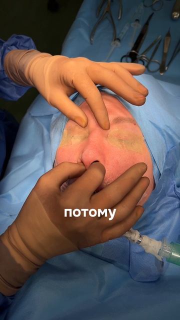 Почему не всегда можно сделать изолированную коррекцию кончика носа? смотреть онлайн