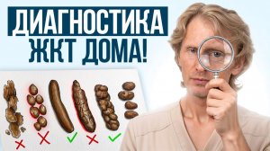 Эти ПРИЗНАКИ говорят о ПРОБЛЕМЕ! / Диагностика ЖКТ по калу дома!