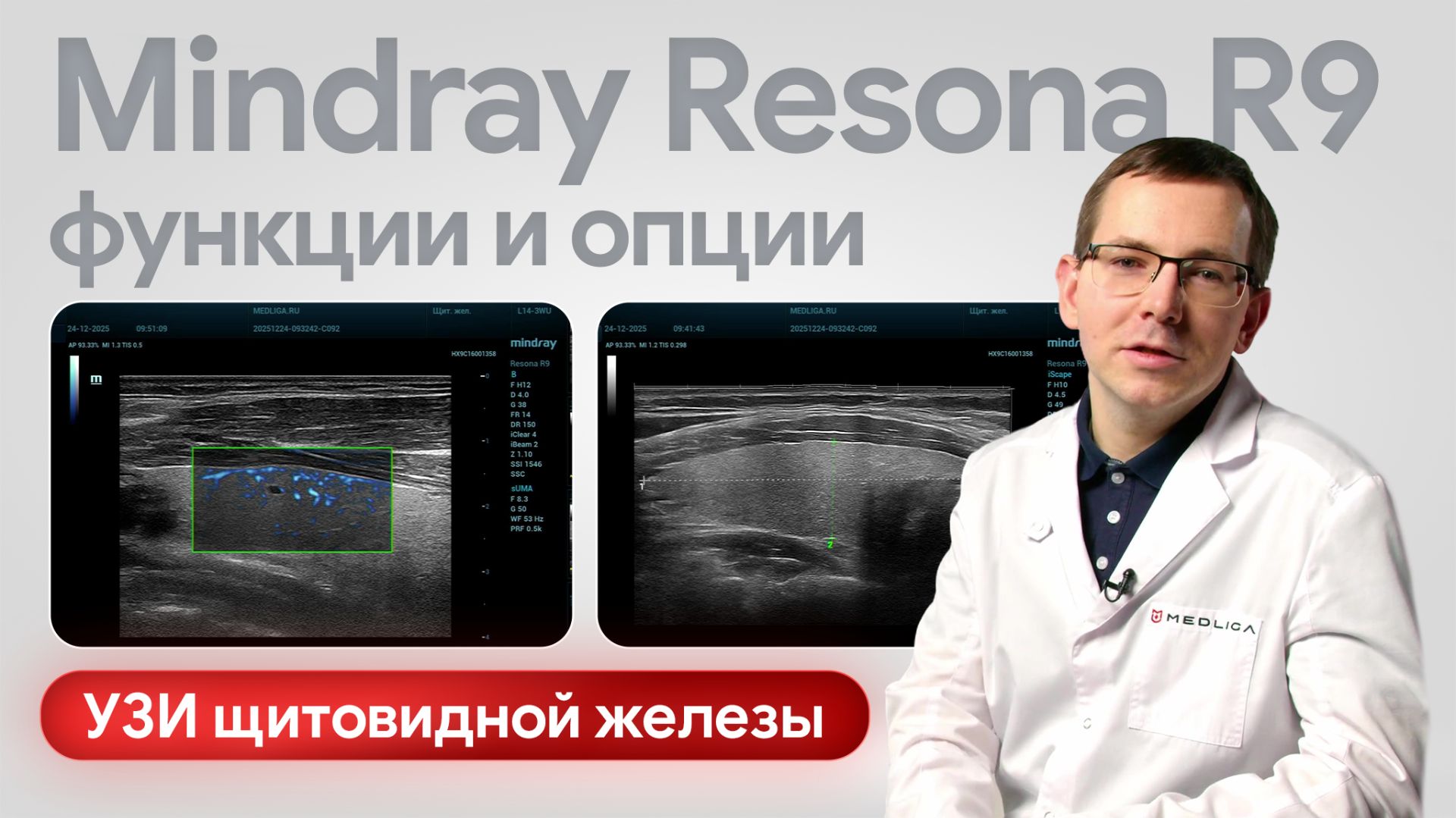 Mindray Resona R9 на практике: УЗИ щитовидной железы