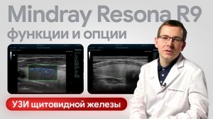 Mindray Resona R9 на практике: УЗИ щитовидной железы