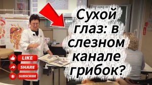 Почему сухой глаз не лечат капли? Нужна противогрибковая терапия