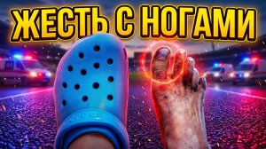 Пробежал Марафон в Крокс — Меня Поймали и Вот Что Стало с Моими Ногами…