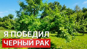 КАК Я ПОБЕДИЛ ЧЕРНЫЙ РАК?! ИТОГИ ПРИМЕНЕНИЯ ЗАЩИТНОГО ЗВЕНА